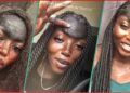 Lady Thanks God for Her Unusual Birthmark on Forehead, Says It Took Her Far in Life